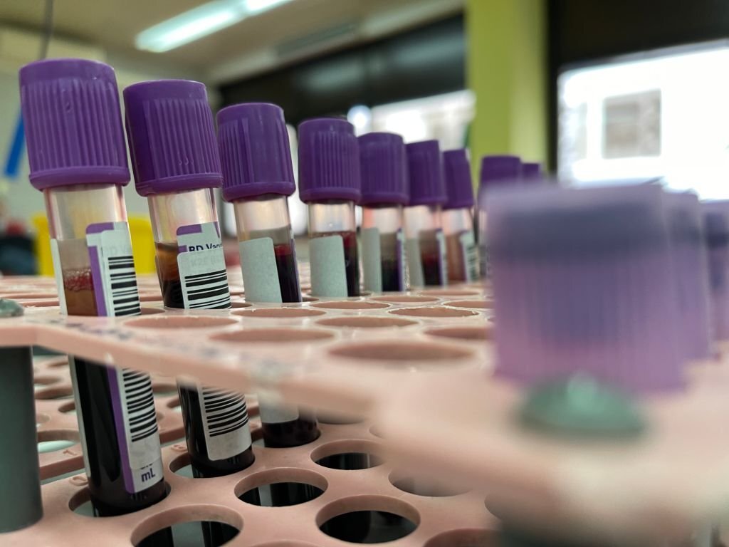 does kratom show up on drug test