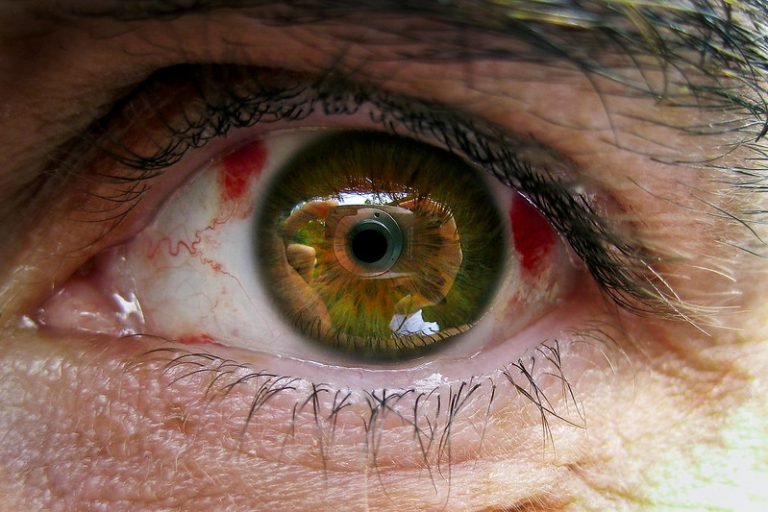 How Long Does It Take To Recover From LASIK