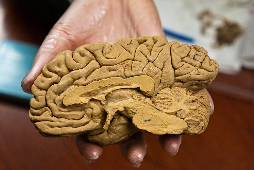 How To Get More Oxygen To The Brain?