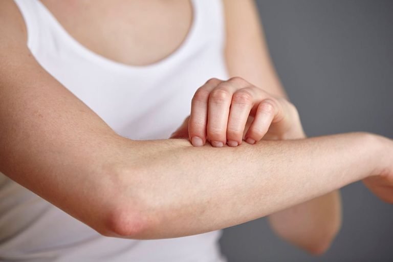 how to tighten loose skin on arms naturally