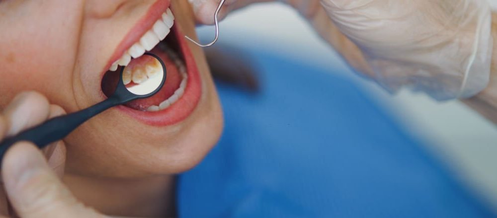 Recognizing The Significance Of Dental Care In Waterloo For Holistic Well-being