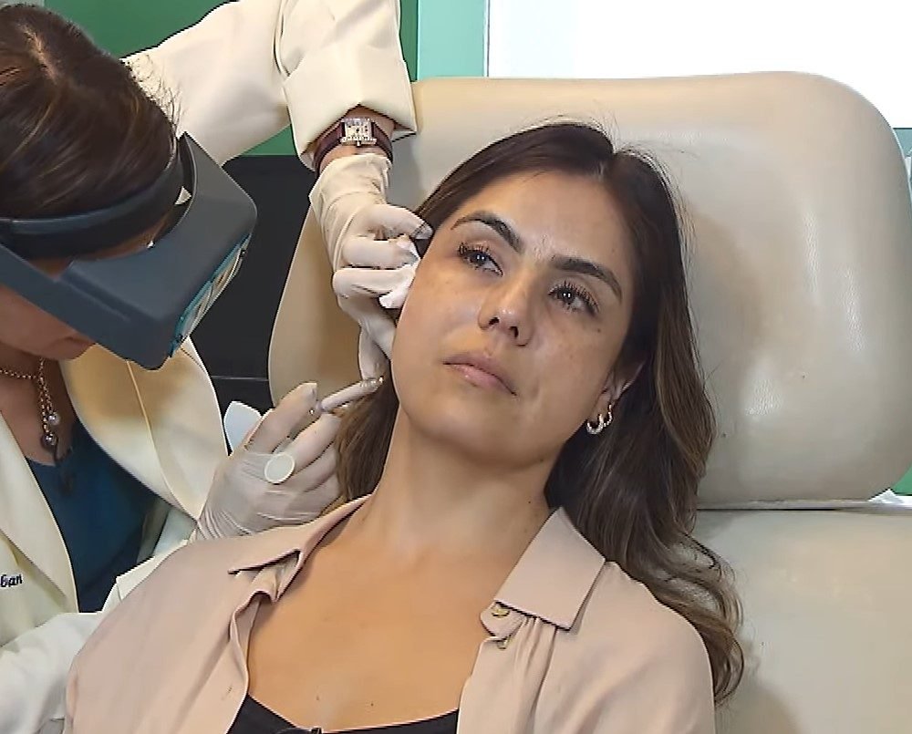Everything You Need to Know About a Facelift