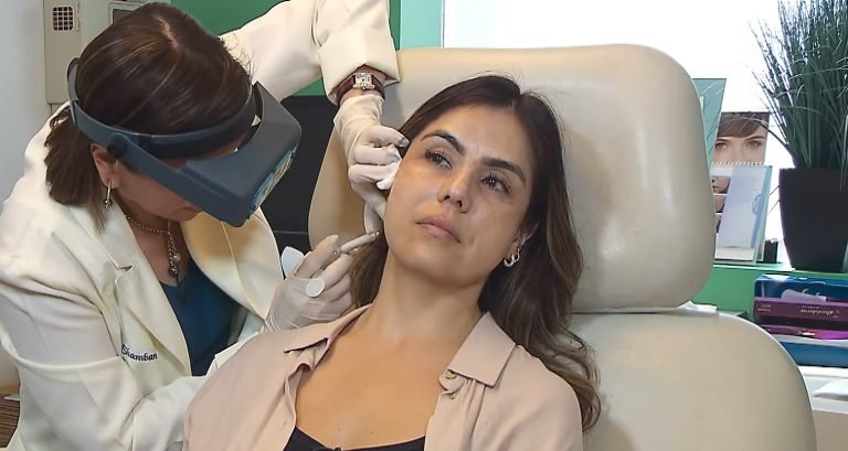 everything you need to know about a facelift