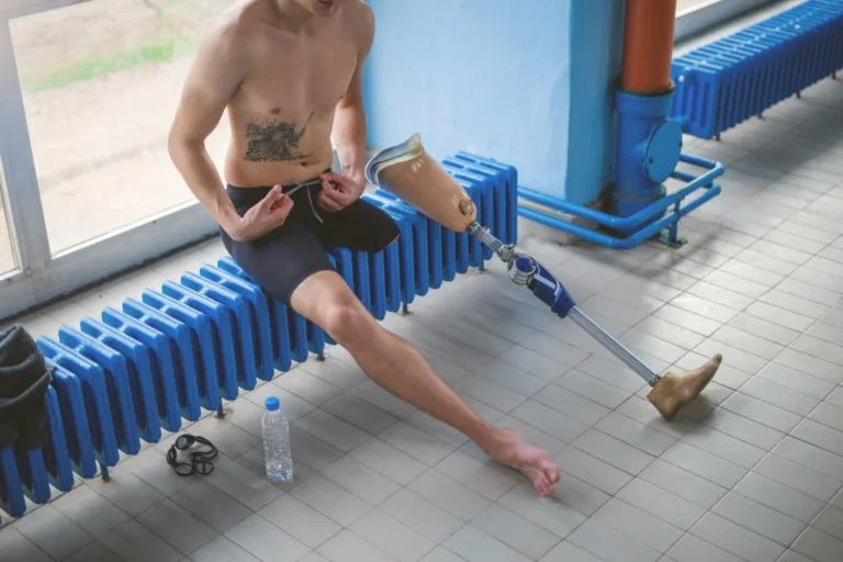 Caring for Your Residual Limb