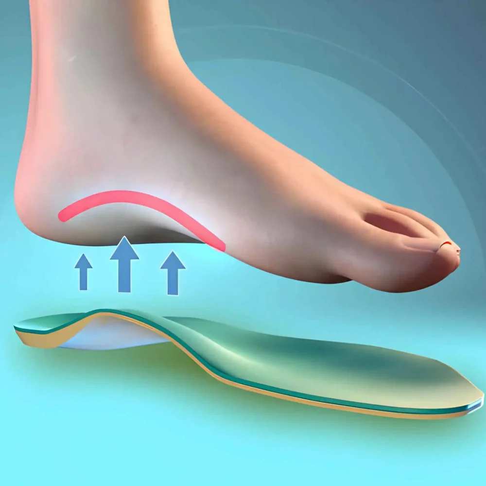 The Ultimate Guide to Choosing The Right Arch Support Insoles for Your Feet