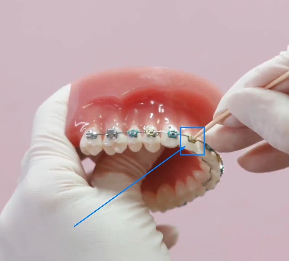 How Long Can You Go With A Loose Bracket?