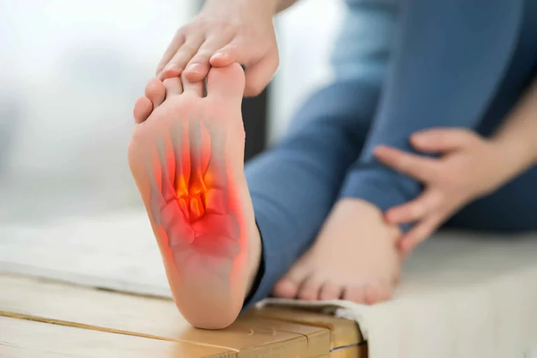 how to cure plantar fasciitis in one week