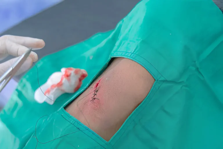 can urgent care do stitches