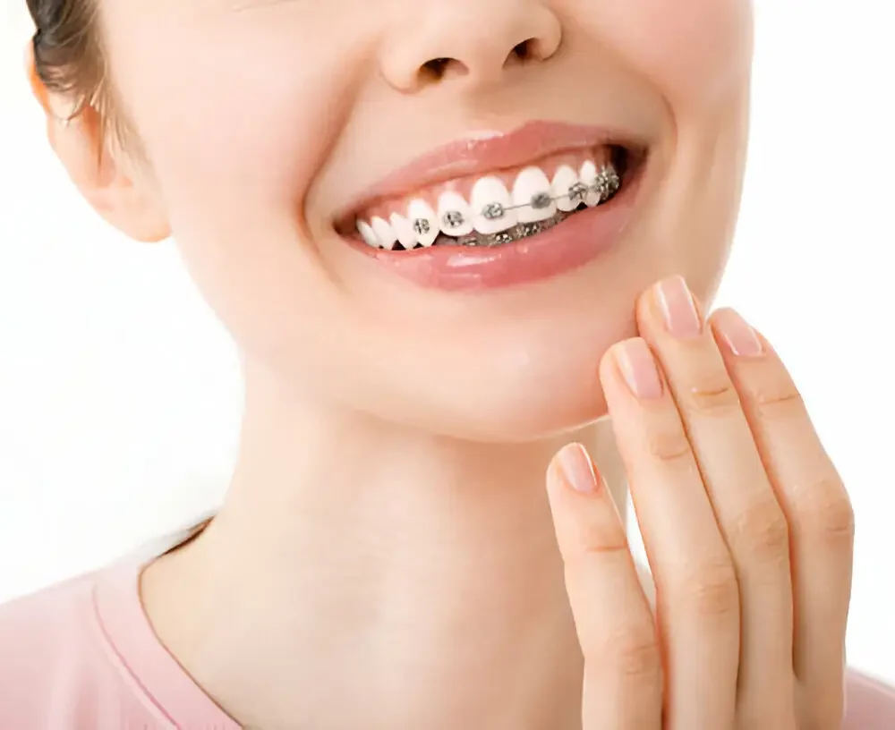 Answering The Most Commonly Asked Questions About Braces