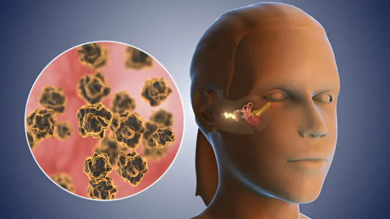 ear wax stuck in ear