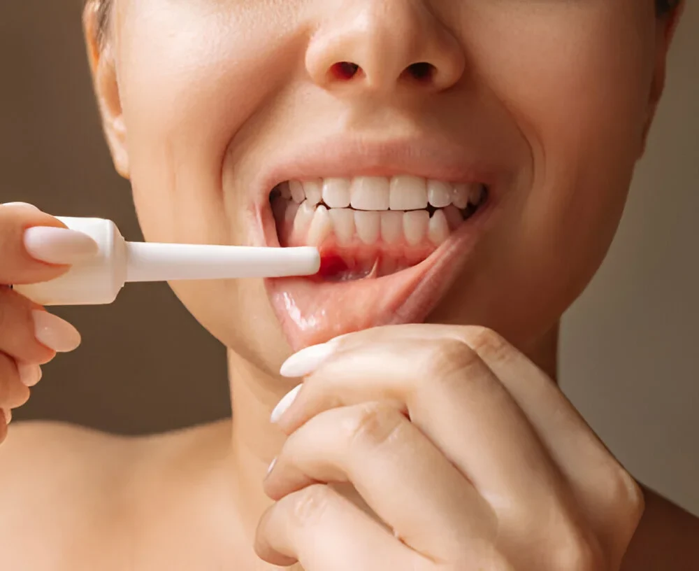 How Long Do Cut Gums Take to Heal