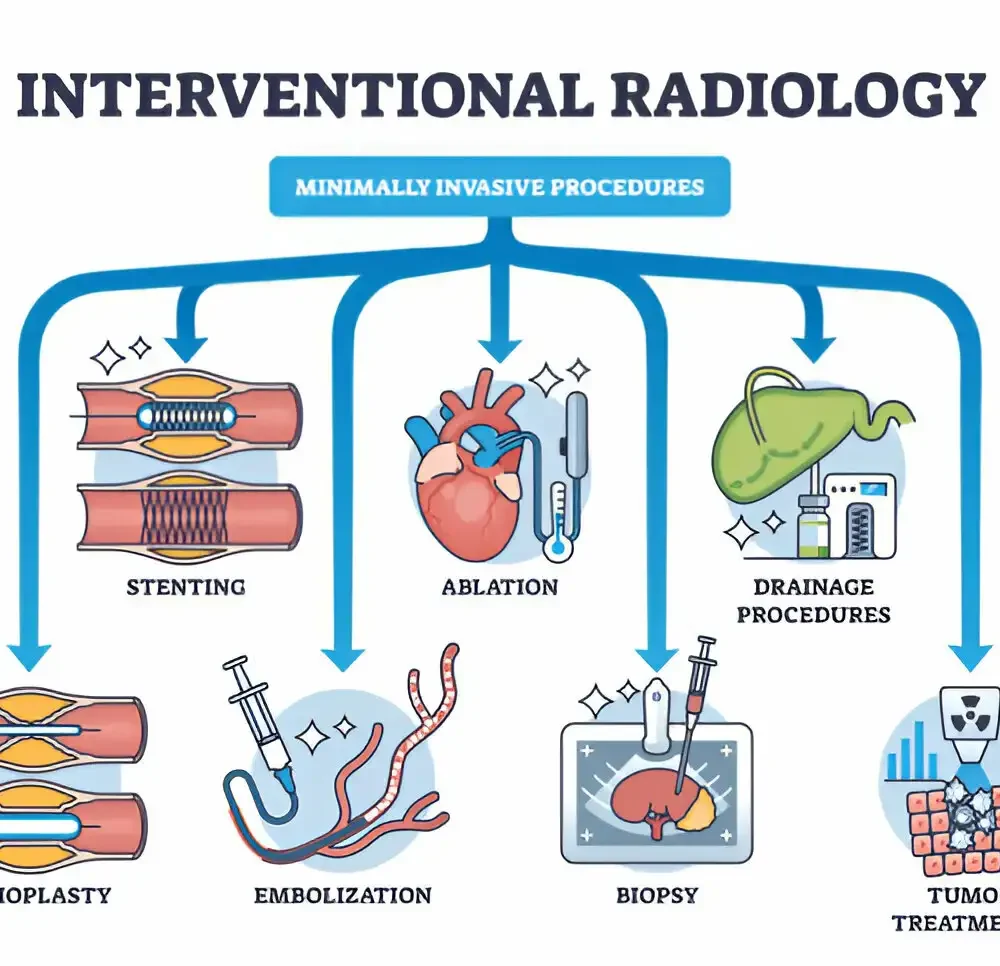 Improving Senior Health: The Impact of Interventional Radiologists