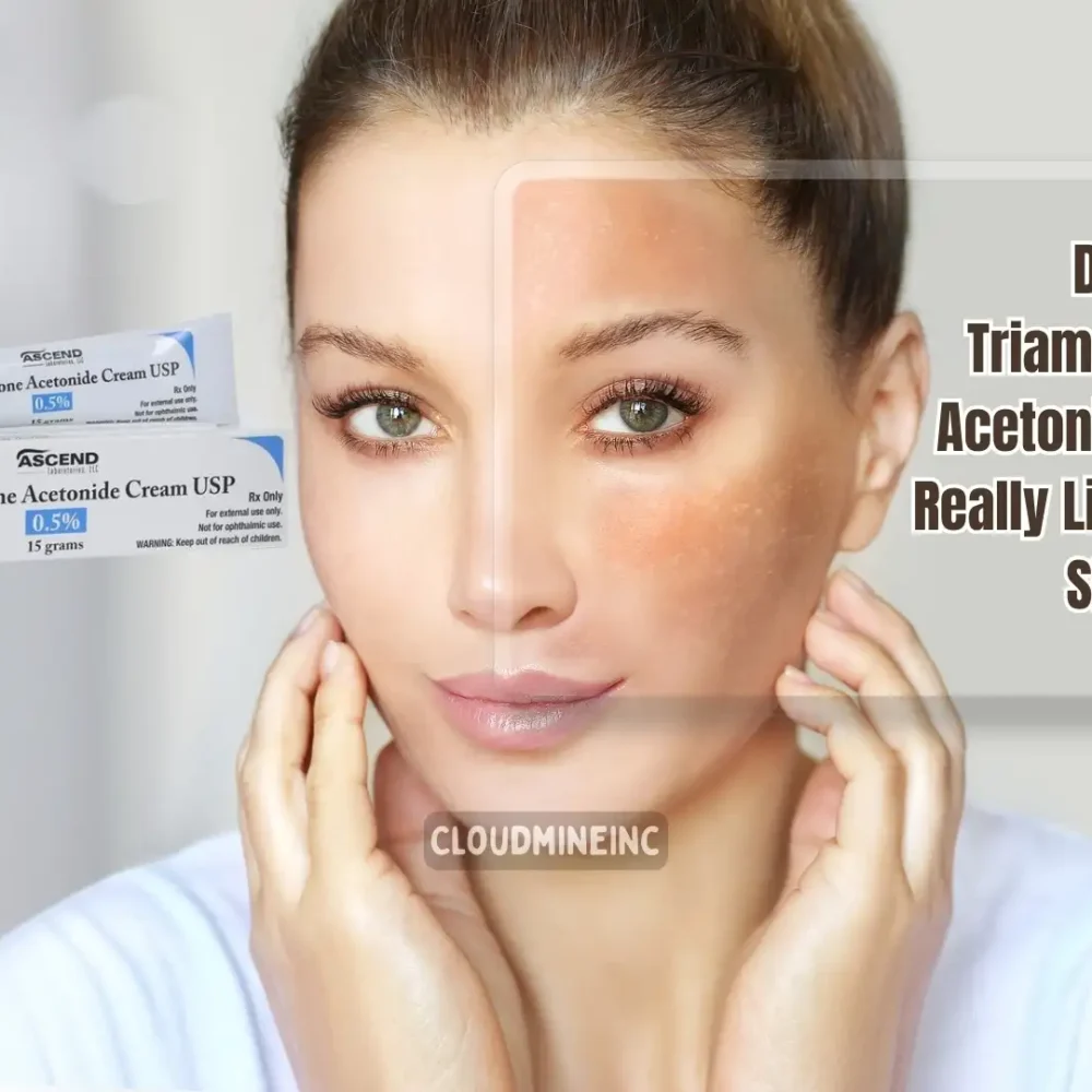 Does Triamcinolone Acetonide Cream Really Lighten Your Skin?