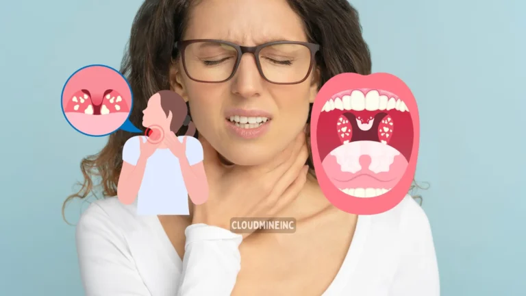 sudden increase in tonsil stones