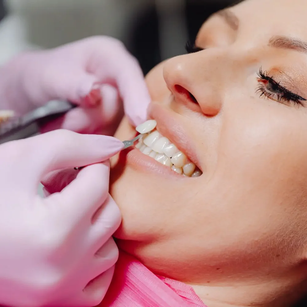 Understanding Common Aesthetic Dental Options: What You Need to Know