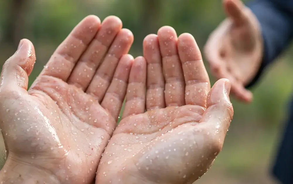 Palmar Hyperhidrosis Treatment: When Do Sweaty Hands Become A Surgical Problem?
